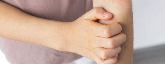 Serata informativa sulla Dermatite Atopica - Novellara